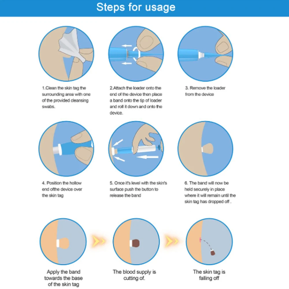 Auto Skin Tag Remover Kit