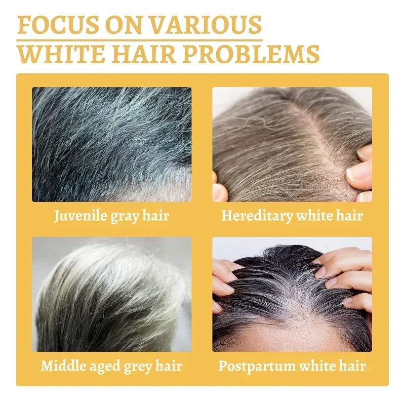 Hair Care Gray White Hair Treatment Serum Liquid White To Black Scalp Dry Damaged Beard Essential Oils Repair Nourish Product Hair Treatment Oil Scalp Treatment