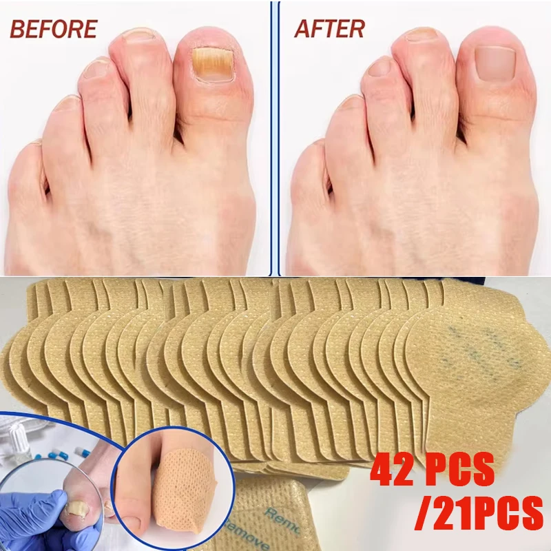 nail fungus patch