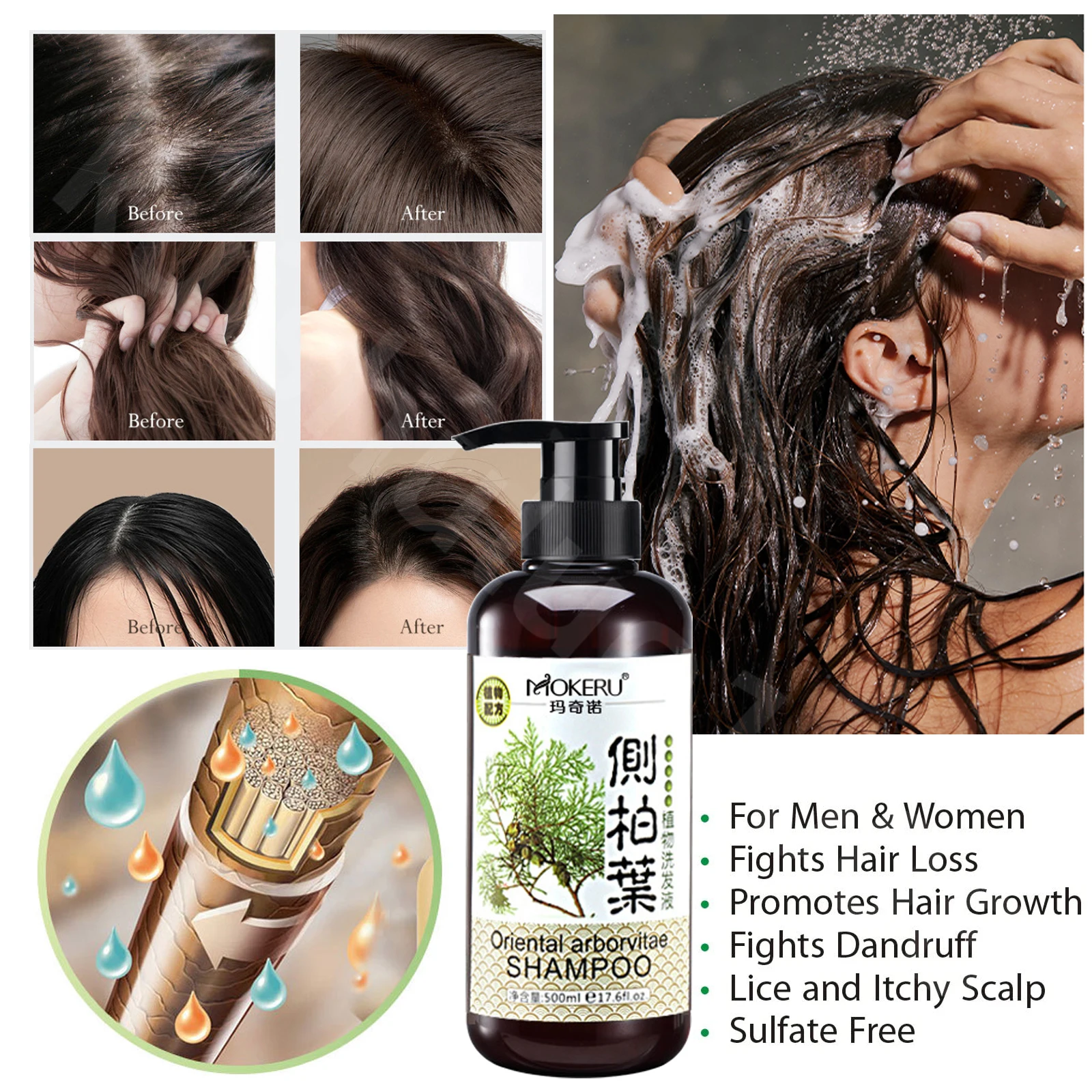

Orientak Arborvitae Thickening Shampoo for Women Men Dry Itchy Scalp Dandruff Hair Loss Moisturize Strong Hair Improve Frizz