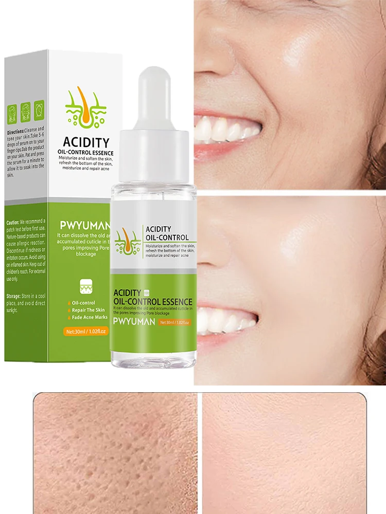 Description Picture 3 of itemAcidity Pore Shrink Face Serum Remove Blackhead Acne Spot Oil Control Moisturizing Repair Nourish Pores Firming Smooth Skin Care