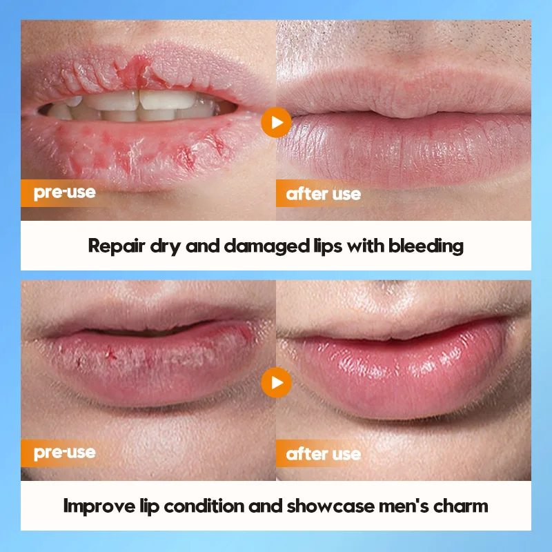 SADOER بلسم الشفاه للرجال ترطيب مكافحة تكسير إصلاح...