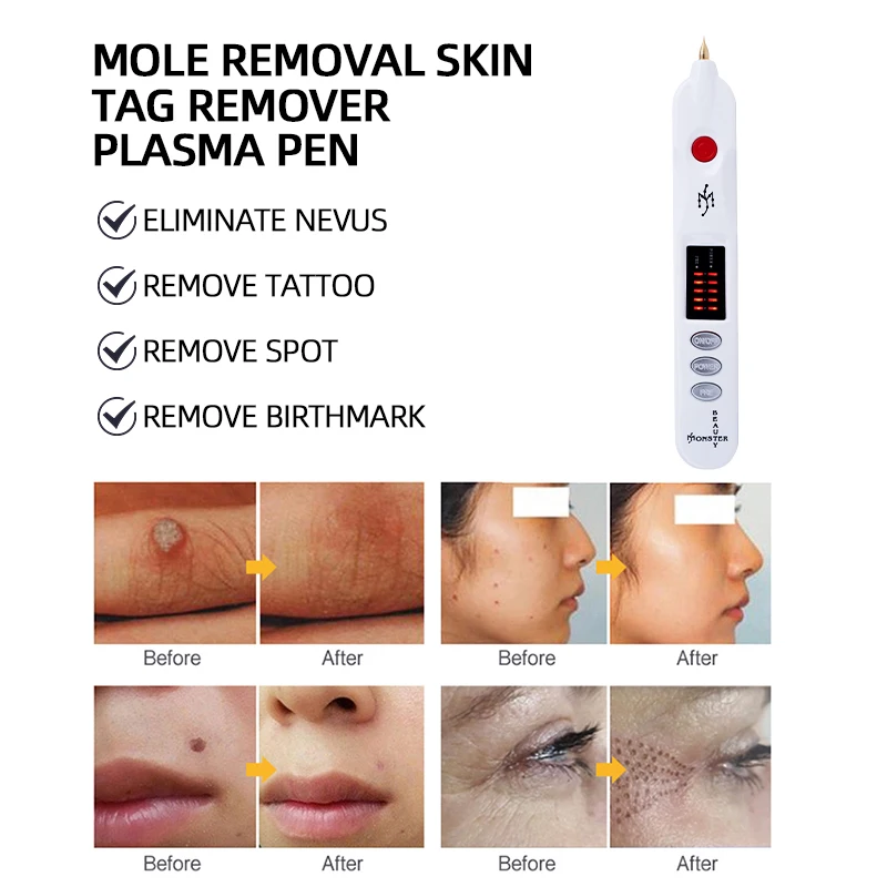 Plasma Pen Mole Removal Pen Mole Removal Black Spot Pigmentation Tattoo Papilloma Wart Skin Care Tool V