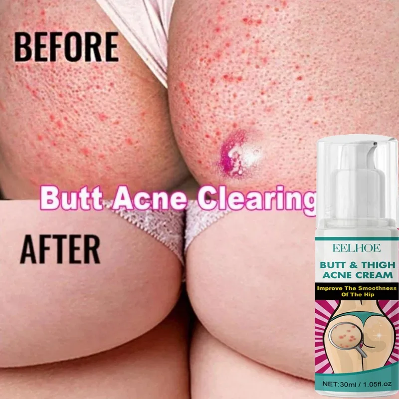 Women Body Lightening Cream Brighten Dull Fade Pimples Moisturize Lotion Butt Inner Thigh Brightening Serum Buttock Smooth Cream whitening body cream whitening cream body lotion brightening cream whitening serum brightening body cream body skin care cream