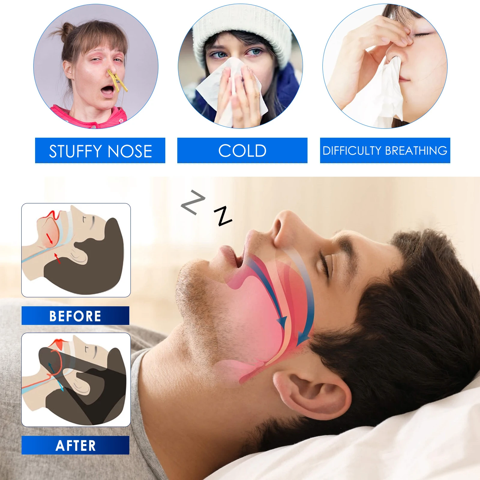 Nose Pincher Snore Strips Snore Strips 10pcs Nose Stop Clips Nasal