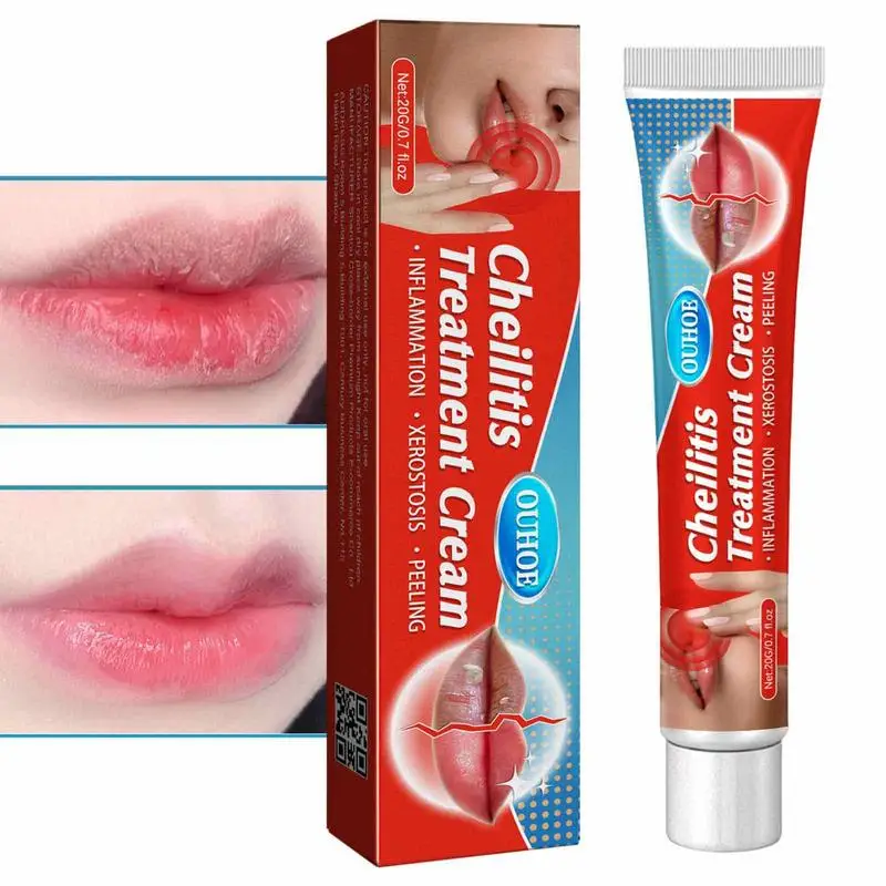 

Sumifun Cold Sores Lip Cheilitis Treatments Cream Herpes Antibacterials Ointment Chapped Lips Wrinkles Rehydration Plaster