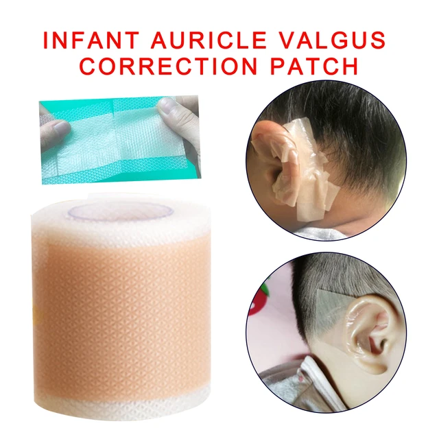 Patch d'Oreille pour Bébé, Autocollant pour Nourrisson - AliExpress