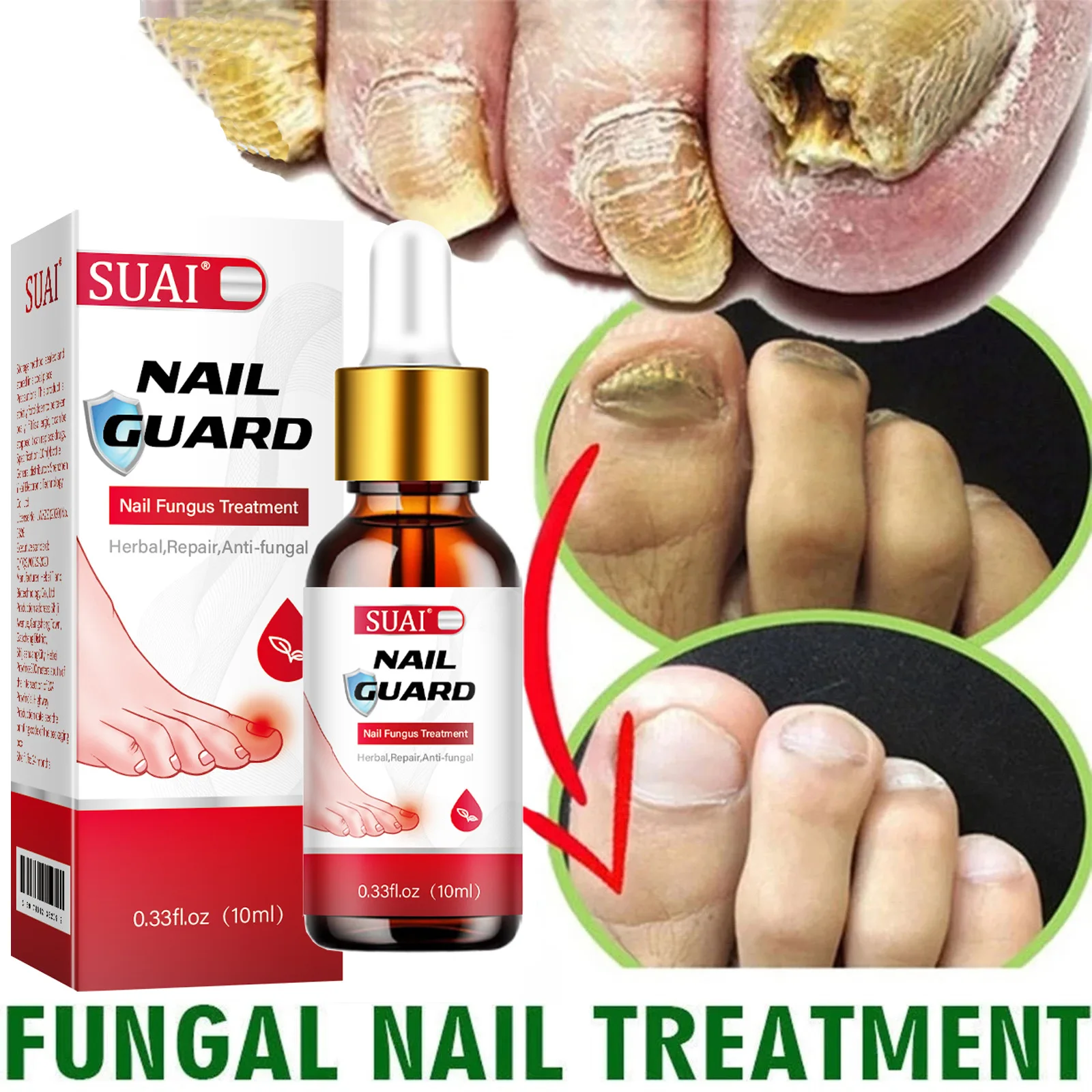 u&ntilde;asFungal Nail Device Repair Fast Nails Fungus Onychomycosis Repair Nails Toenail Fingernail Removes Nail Fungus Foot Treatment nail fungus remover