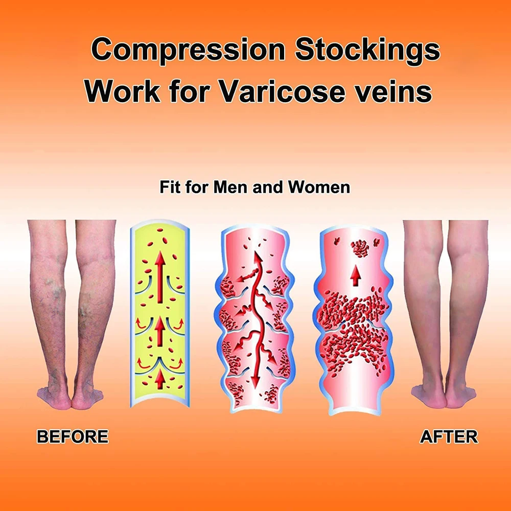 1Pair Calf Compression Sleeves 20-30mm Hg Firm Support Varicose Veins Socks  for Swelling, Pregnancy, Recovery, Exercise, Cycling