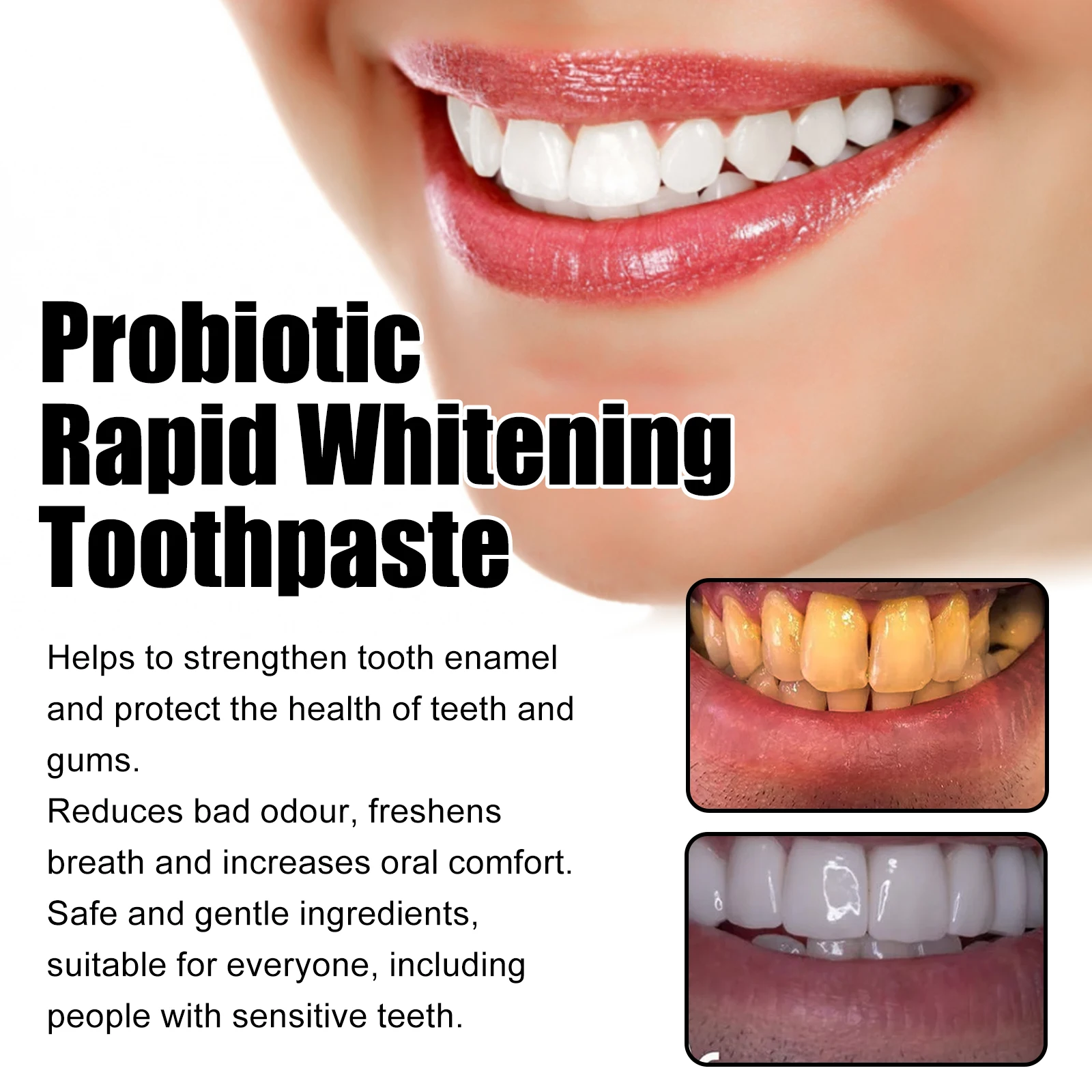 Oralhoe probiotic whitening toothpaste,Oral cleaner,Tooth Color Correction,Care For Oral Health Teeth Whitening Toothpaste