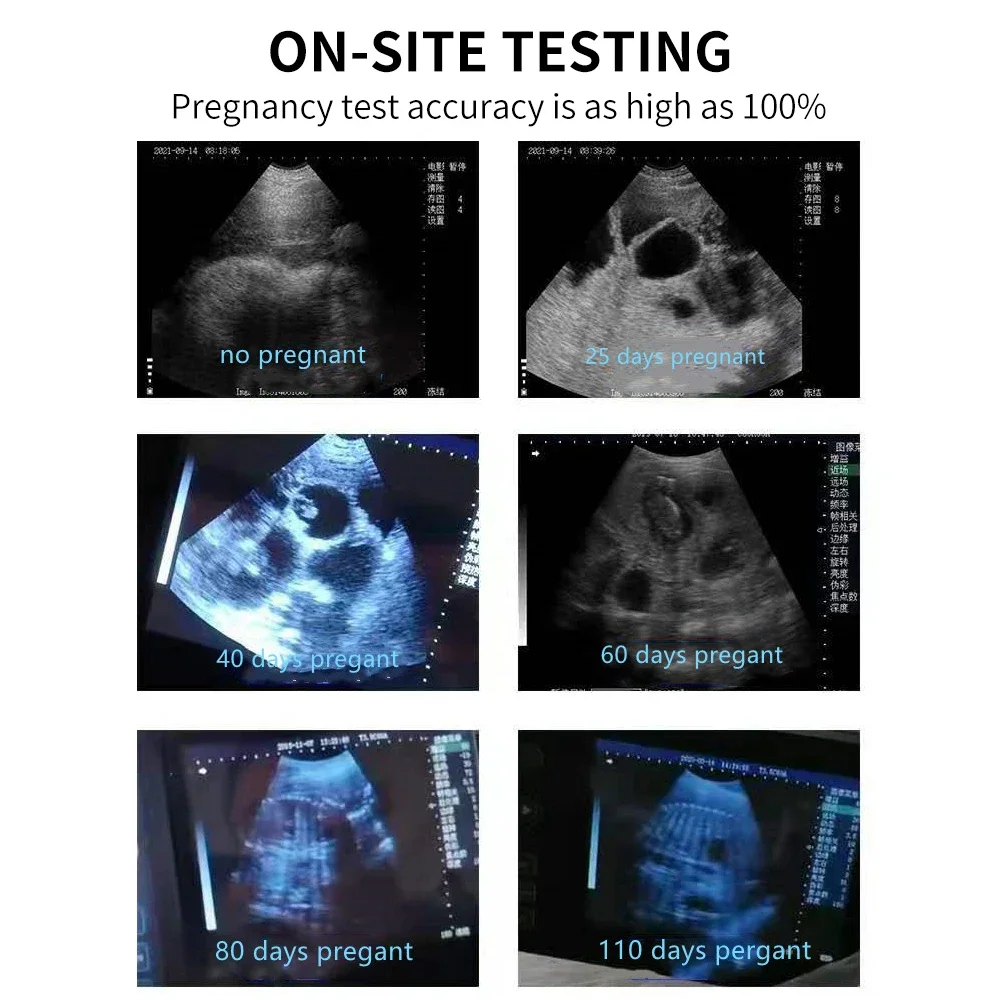 Veterinary Ultrasound Vet Handheld Scanner veterinary pregnancy Ultrasound Machi