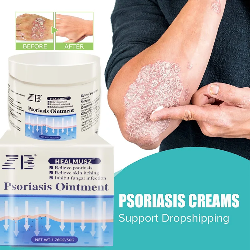

Natural Plant Extracts Psoriasis Cream Removal Psoriasis Eczema Best Against Psoriasis Dermatitis Products Medical Plaster