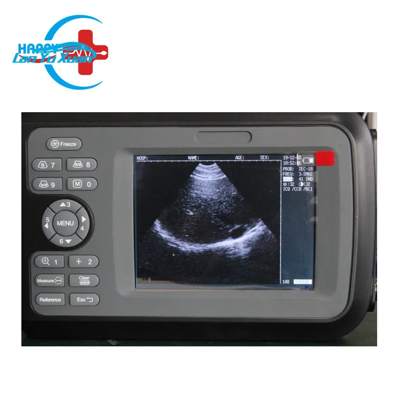 

HC-A032V Veterinary Handheld Ultrasound Scanner For Pregnancy/Portable Animal Ultrasound Scanner