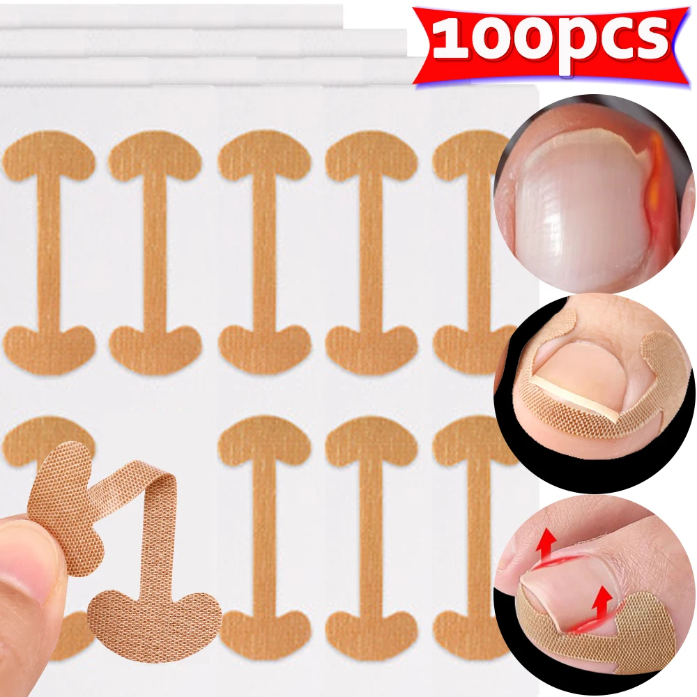 Nail Correction Stickers 100pcs Professional Painless Ingrown Toenail Correction Strips Waterproof Breathable Treatment Pedicure