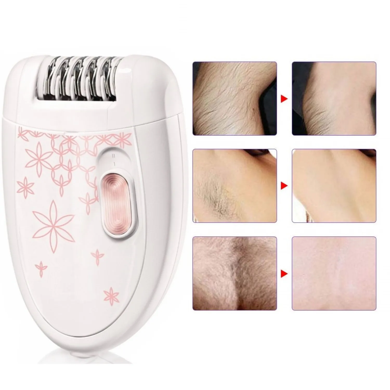 Epilelétrico feminino, removedor de pelo corporal, underpara