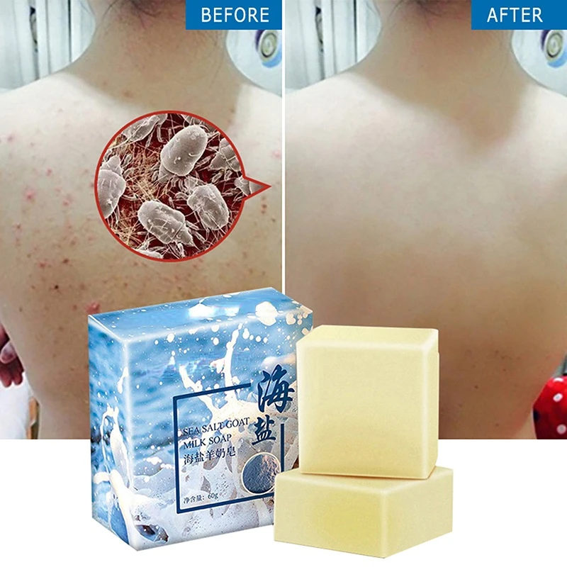 

Sdotter Sea Salt Soap Facial Cleaner Pimple Acne Remover Opens Pores Goat Milk 80g