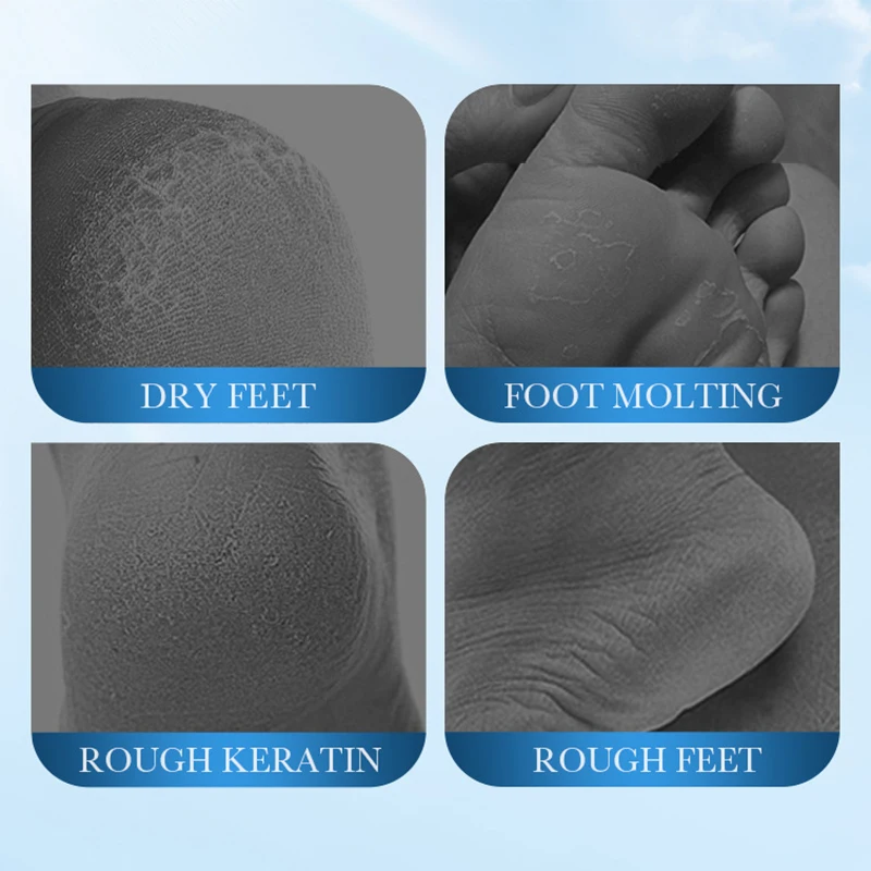 SADOER Coconut Foot Mask Moisturizing Whitening Foot Peeling Mask Anti-aging Exfoliating Feet Pedicure Exfoliant Feet Skin Care