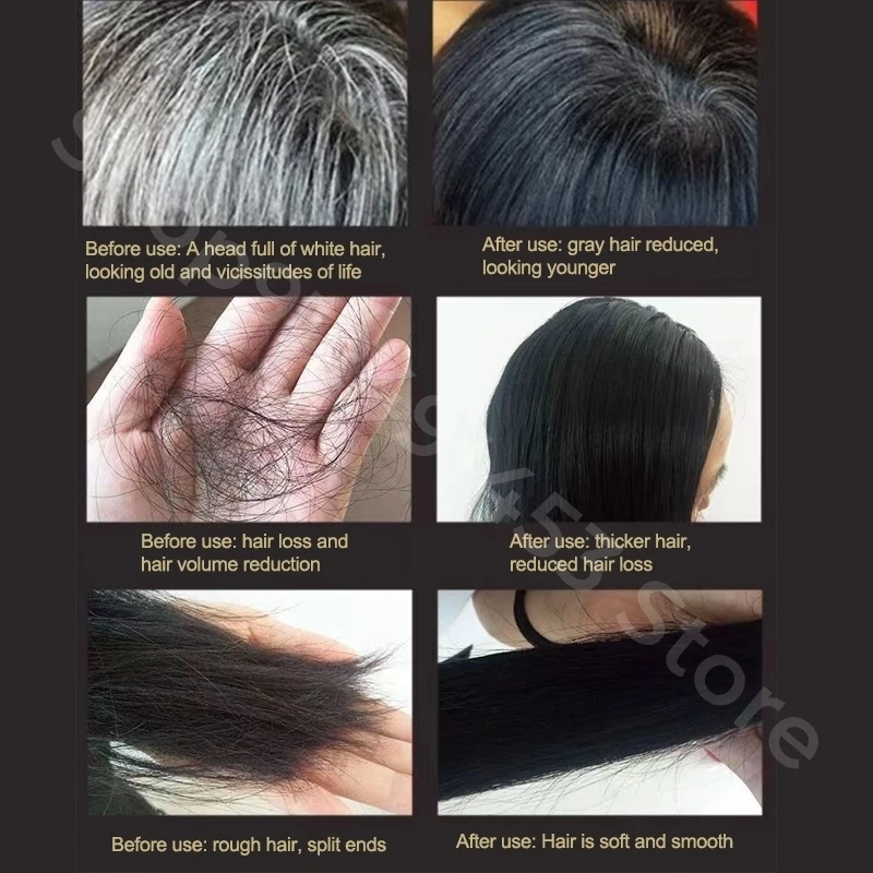 Black Ganoderma and Polygonum Multiflorum Plant Shampoo Repairs and Nourishes Damaged White Hair and Turns It Into Black Hair 5