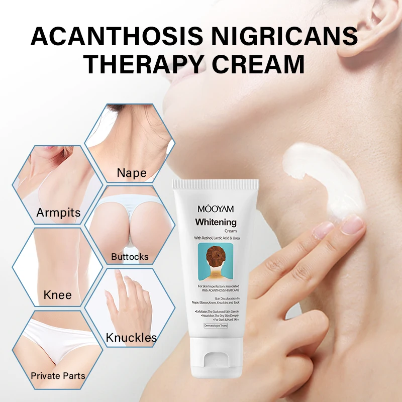 Acanthosis Nigricans Therapy Neck Cream Skin Tightening Underarm Elbows Armpit Cream Treatment Dark Spot Remover For Body 3
