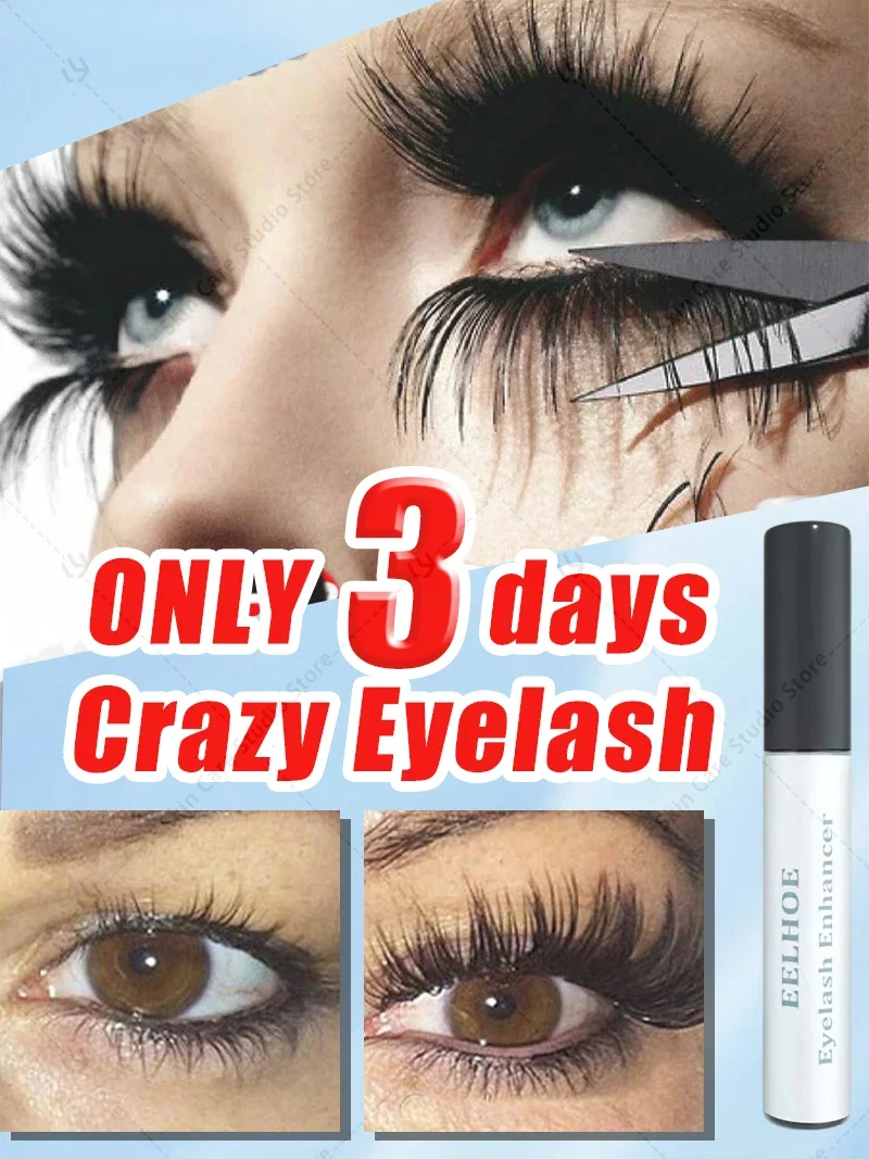 Growth of eyelashes.