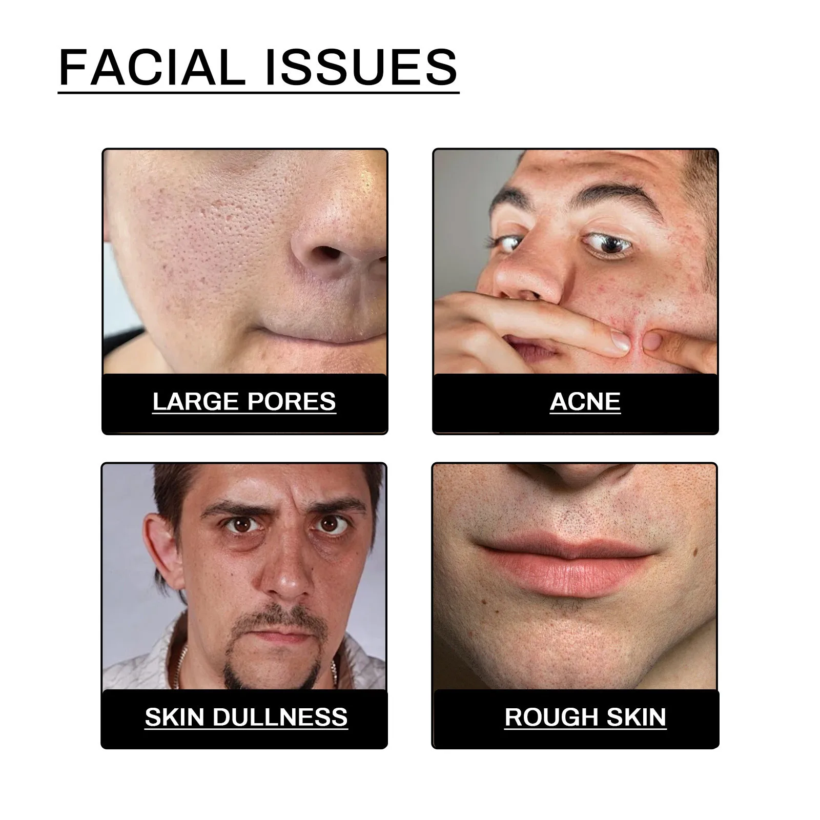 Men Facial Cleanser Lotion Remove Acne Blackhead Prevent Clogged Pores Oil Controll Exfoliator Refreshing Facial Cleaning Cream 3
