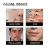 Men Facial Cleanser Lotion Remove Acne Blackhead Prevent Clogged Pores Oil Controll Exfoliator Refreshing Facial Cleaning Cream 3