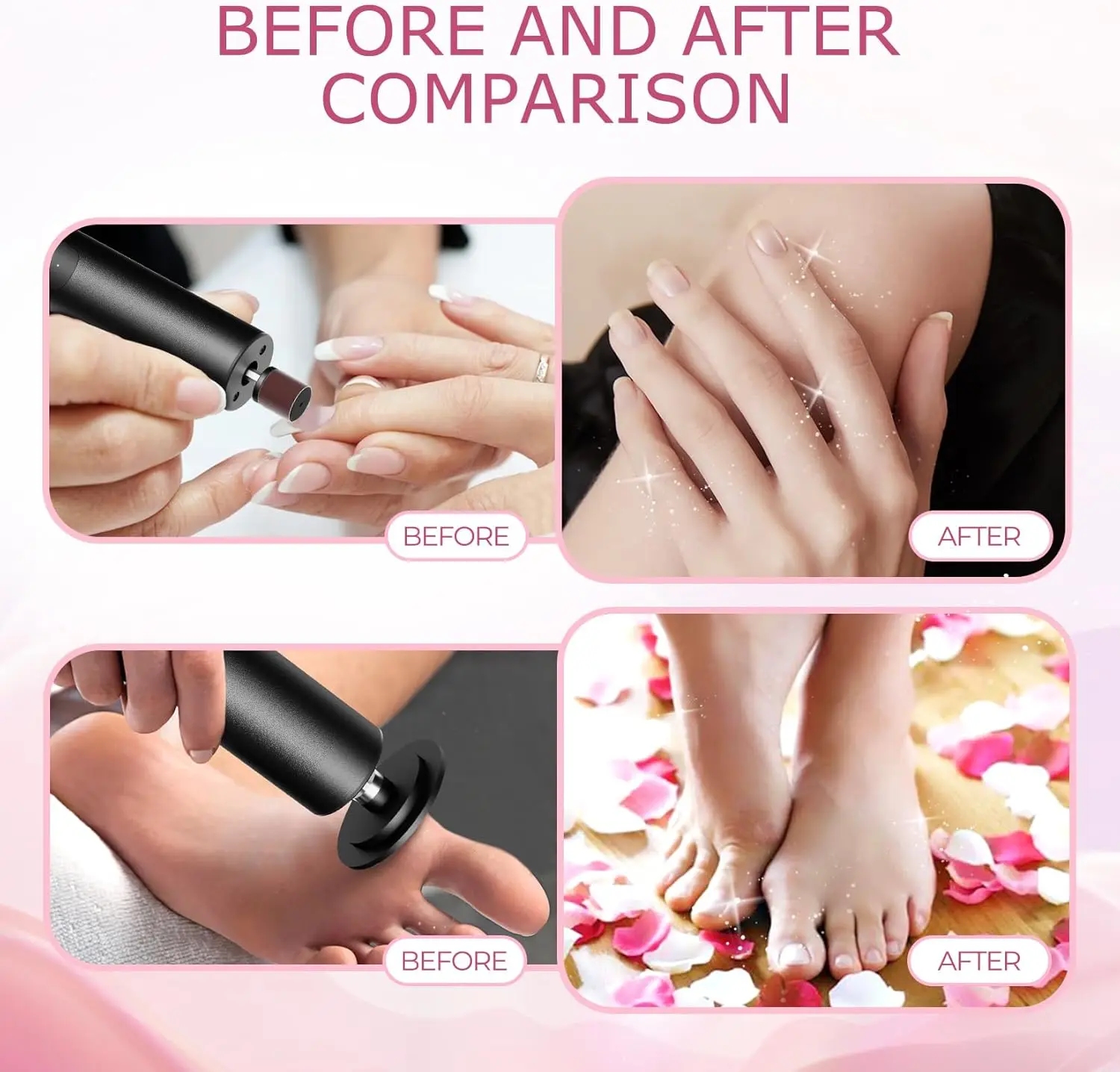 Electric Foot Callus Remover 2 in 1 Foot File Nail Grinder with 6 Speed with Sandpaper Foot Sander Tool for Feet Dry Dead Skin