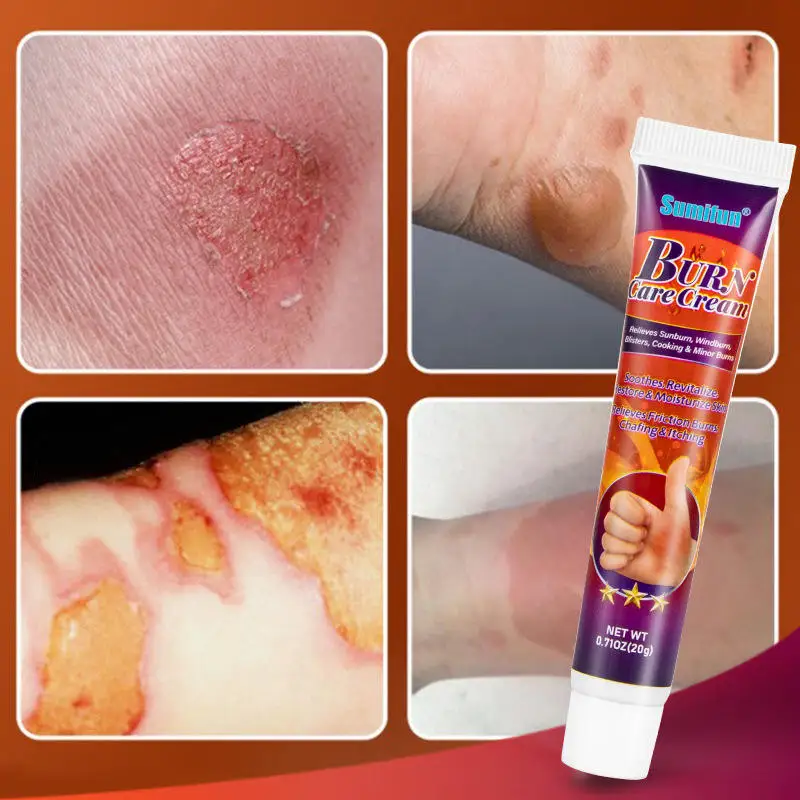 First Aid Burn Care Cream Relieves Sunburn Windburn Blisters Cooking Minor Burns Skin Care