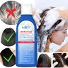 Selenium Disulfide Shampoo Oil Control Refreshing Anti-itch Scalp Cleansing Shampoo Nourishing and Smoothing Shampoo 230ml 3