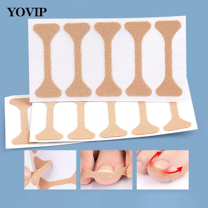

5/15/30 Pcs Ingrown Paronychia Toenail Corrector Strips Anti Fungal Nail Correction Stickers Anti Infection Nail Treatment Patch