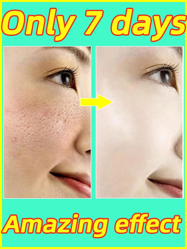 Pore Shrinking Serum Pores Minimizer Cleaning pore shrinking serum cleaner remover open pores face cleaning contraction minimizer facial cleansing