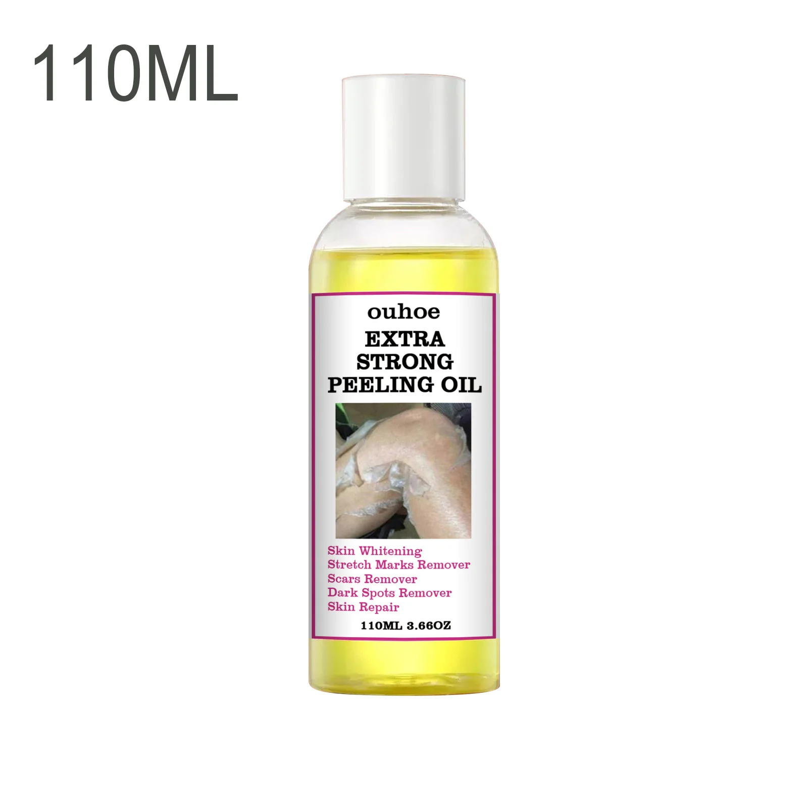 thumbnail image 1 of Aceite esencial de planta para exfoliación amarilla de 110 ml que blanquea, aclara codos, rodillas y manos, y aclara el tono de la piel, aceite para masajes faciales y corporales, 1 of 5