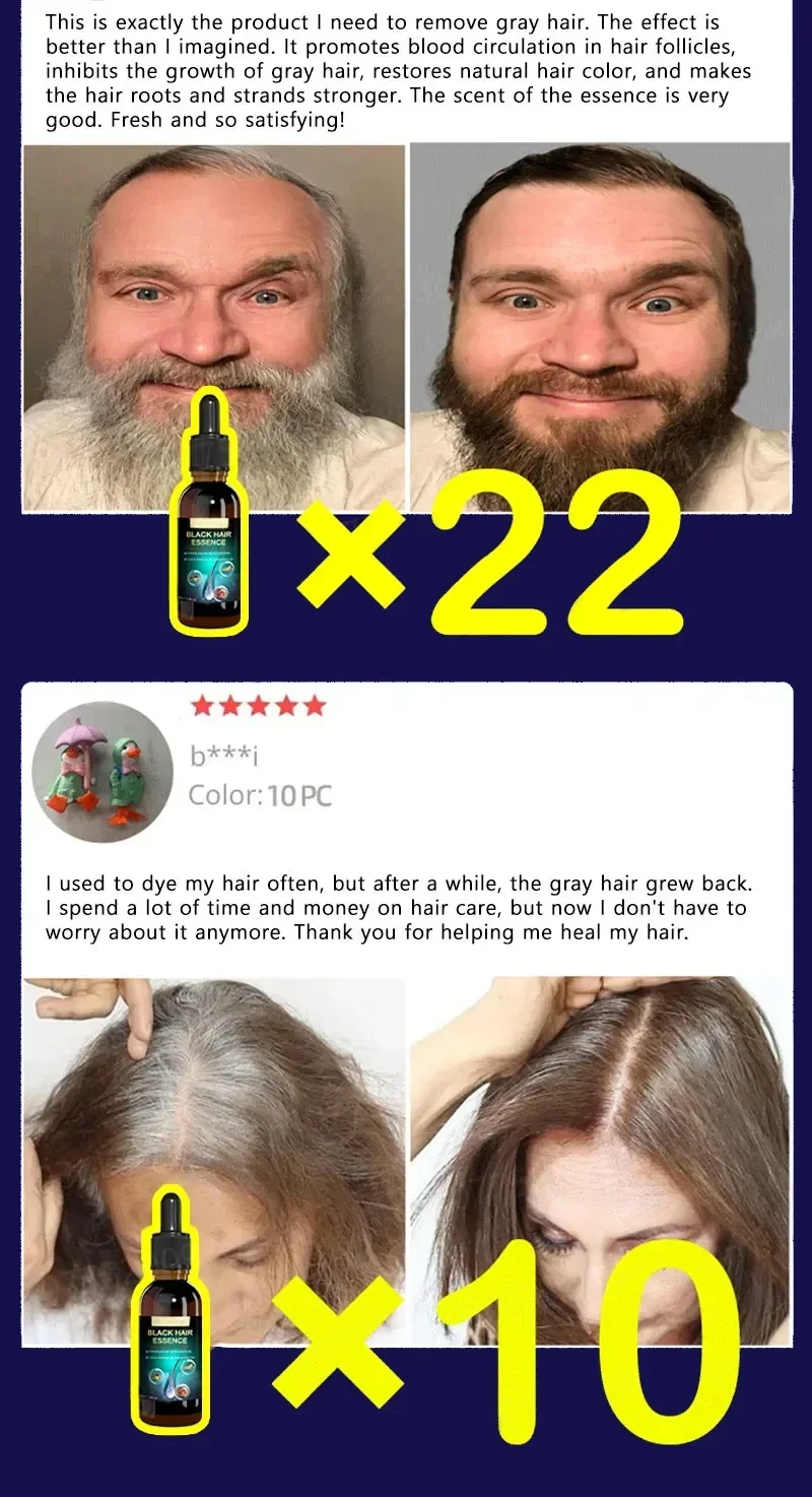 Description Picture 4 of itemAnti-grey hair essence Serum treatment restore natural hair color and restore healthy White To Black hair