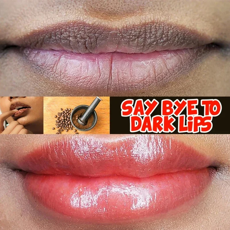 Lips Pink Fresh Lightening Bleaching Cream Treatment Remove Dark Smoke Lips Lip Balm Whitening Moisturizer Nourishing Essence