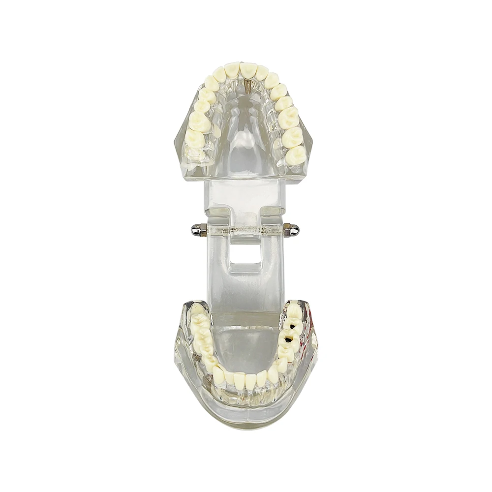 Dental Restoration & Disease Analysis Teaching Model