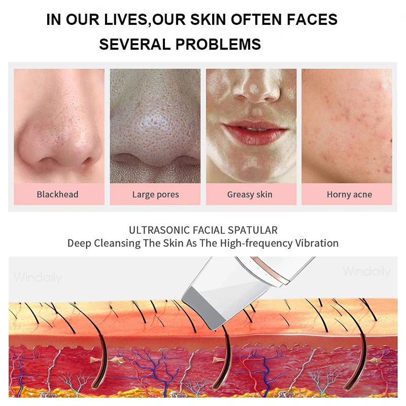 Spatulă cu ultrasunete pentru curățarea pielii, vibrații, pentru îndepărtarea punctelor negre, lopată, cavitație, peeling, lifting facial_voghion.com