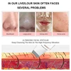 Ultrasonic Skin Scrubber Vibration Face Spatula Blackhead Remover Shovel Clean Cavitation Peeling Facial Lifting Skin Care Tools 5