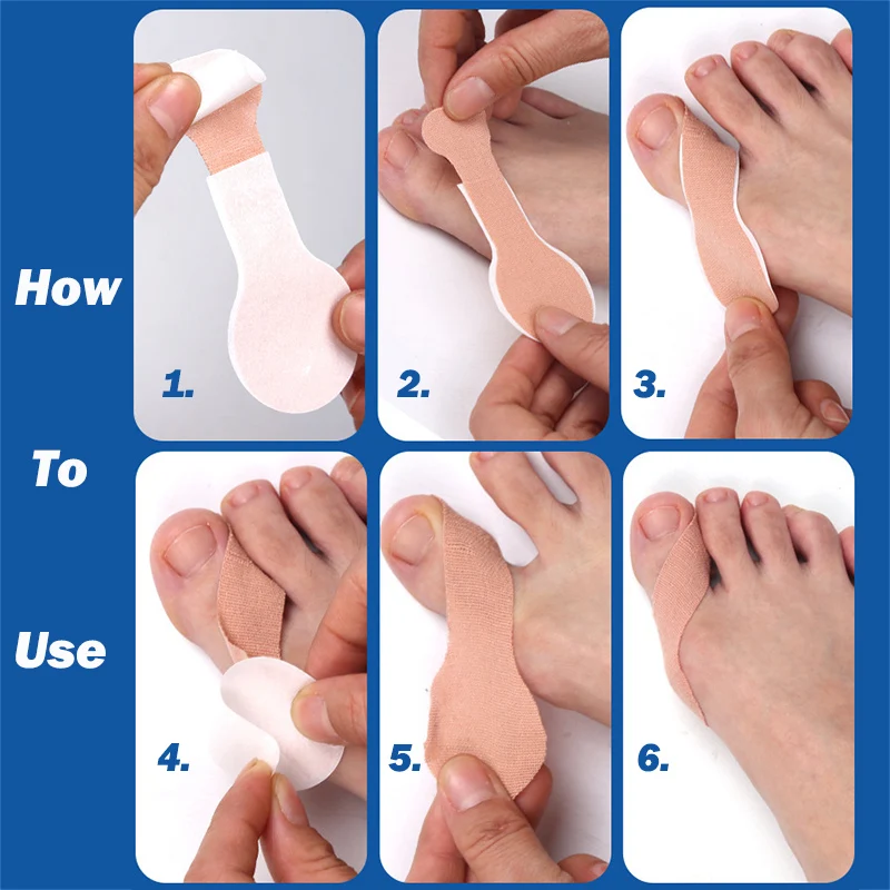 Moleskin Turf Toe Strap with Pressure Sensitive Adhesive Plantar Fasciitis Relief Strips Relieve Big Toe Pain Pexmen 1/3/5/10Pcs