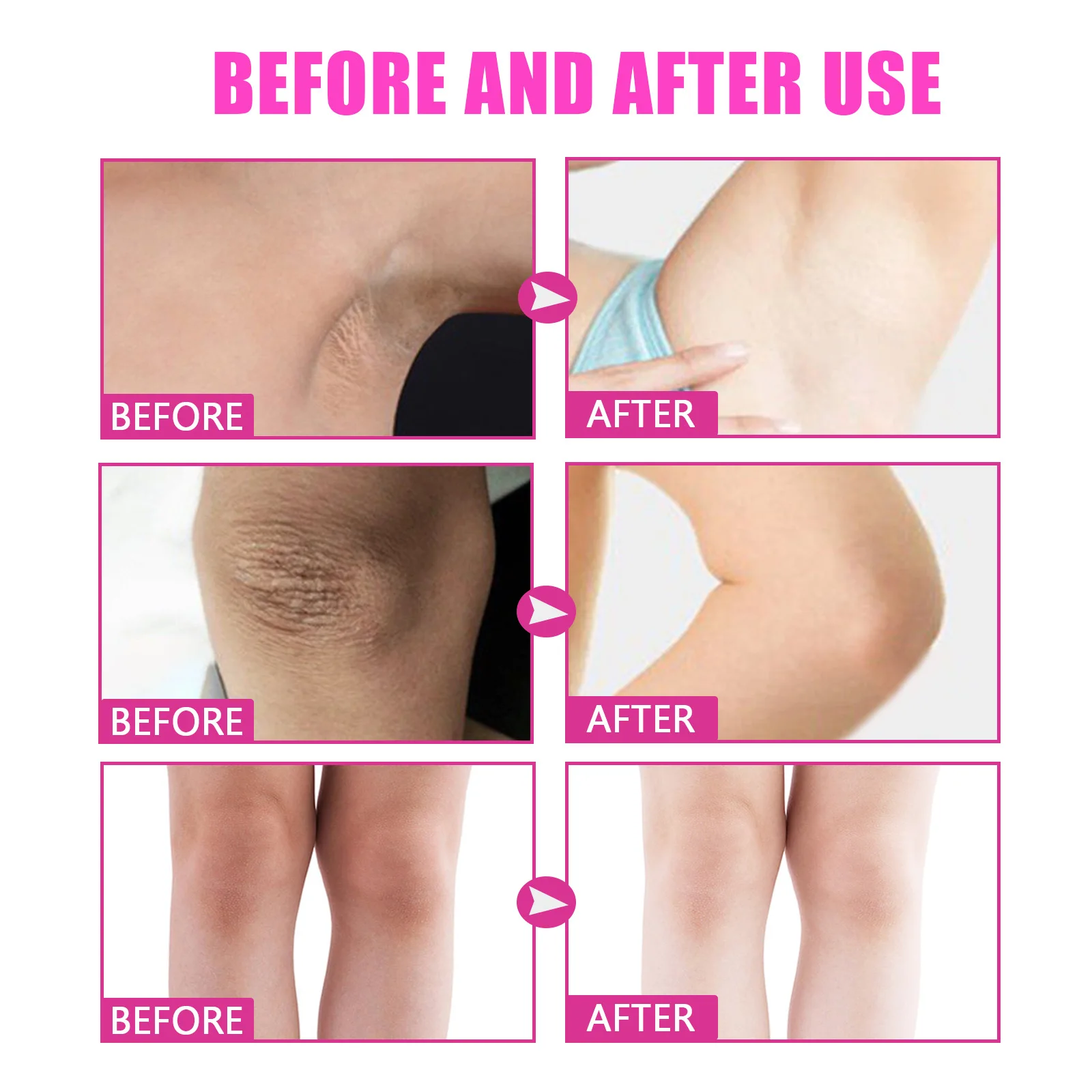 Whitening Cream Knee Buttock Inner Thigh Bleach Remove Melanin Dullness Fade Dark Spots Nourishing Underarm Brightening Cream 6