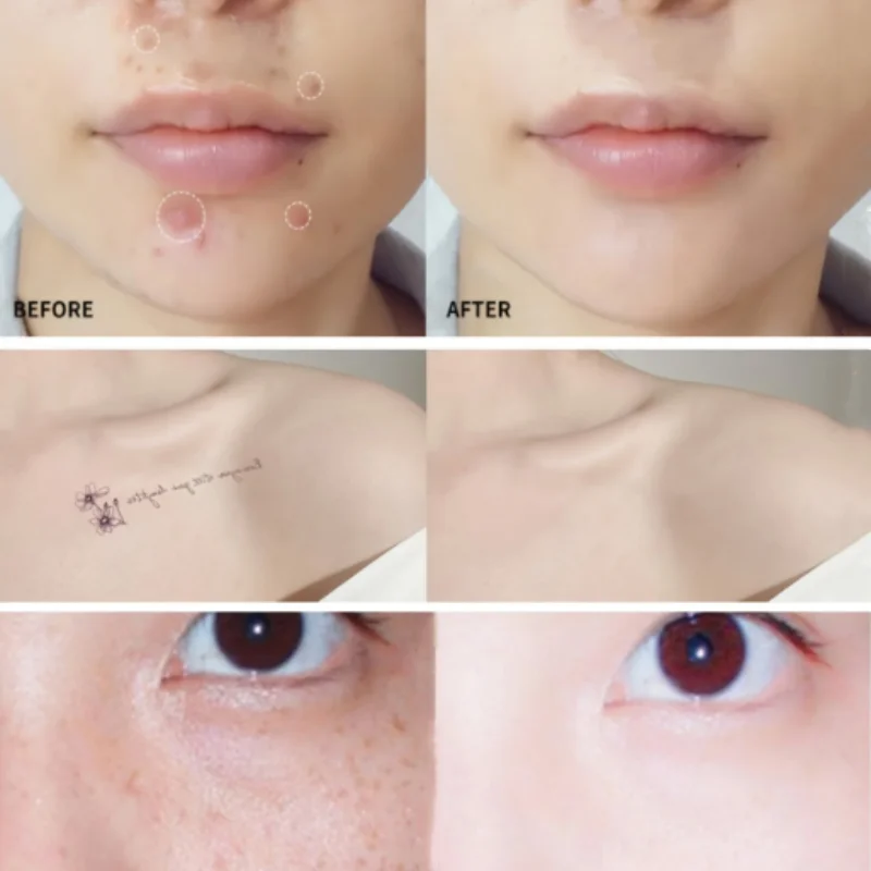 Concealer Foundation Cream Full Cover Dark Circles Acne Spots Dark Circles For Tattoos Scars Natural Finish Makeup Base Contour