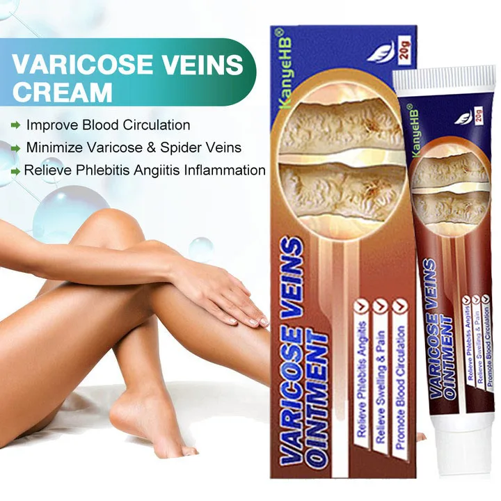 

Effective Varicose Vein Relief Cream Ointment For Varicose Veins To Relieve Vasculitis Phlebitis Spider Legs vessel Treatment