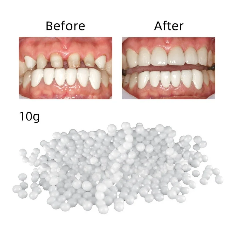 

Sdotter 15g/25g Temporary Tooth Repair Kit Teeth and Gaps FalseTeeth Solid Glue Denture Adhesive Teeth Whitening Tooth Beauty To