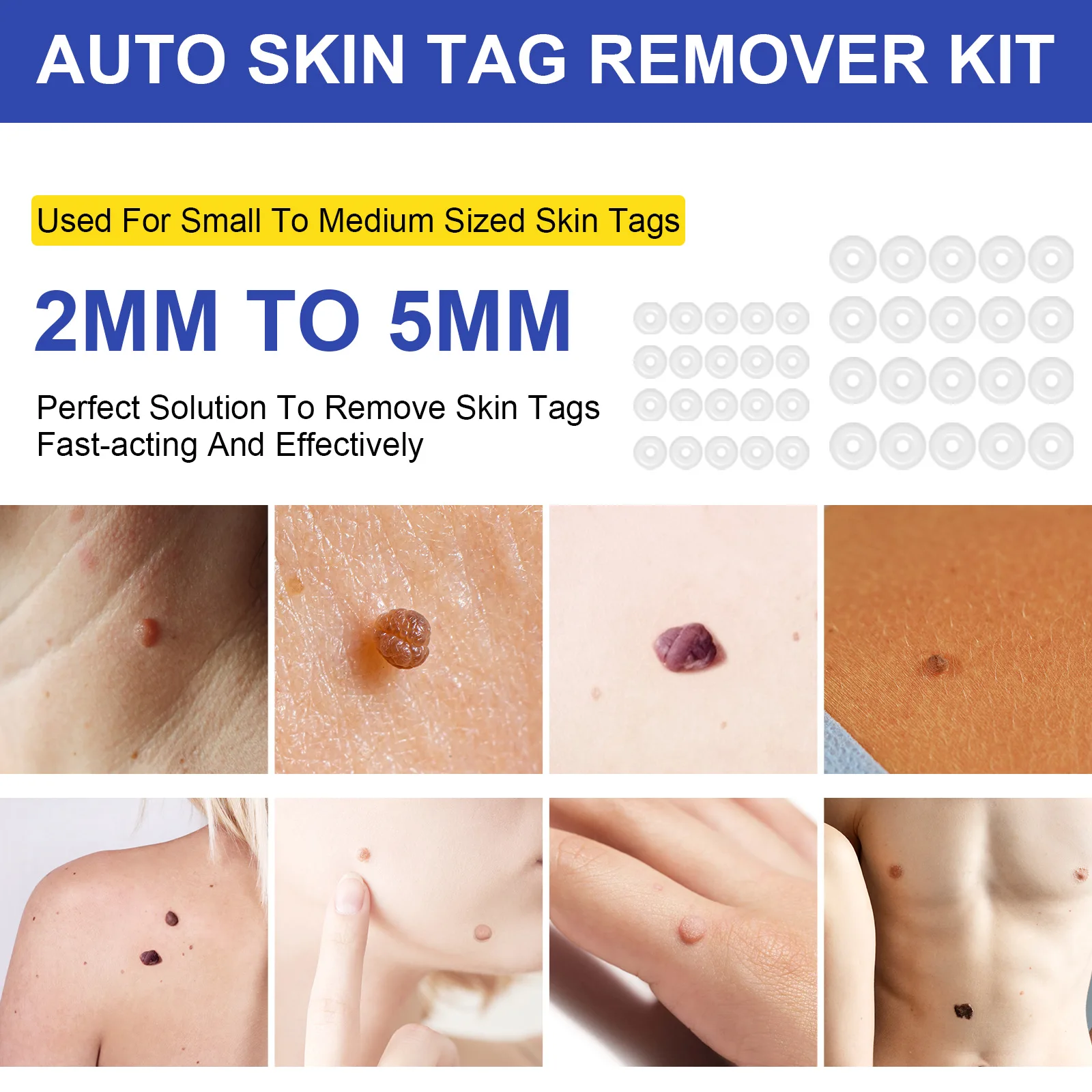 2-IN-1 Wart Removal Kit Meat Polka Dots Warts Acne Flesh Mole Face Pot Fast Removal Kit Unisex Body Skin Tag Care Tools