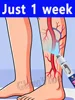 ⱽᵃʳⁱᶜᵒˢᵉ ᵛᵉⁱⁿˢ ⁱⁿ ᵗʰᵉ ˡᵉᵍˢ Veins in the feet, hands, and throughout the body