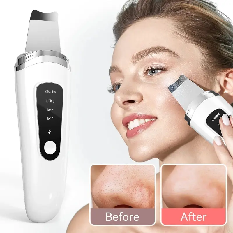 Scrubber Per La Pelle Ad Ultrasuoni Peeling Rimozione Di Punti Neri Pulizia Profonda Del Viso Ultrasuoni Ion Ance Pore Cleaner Detergente Per Pala Fac