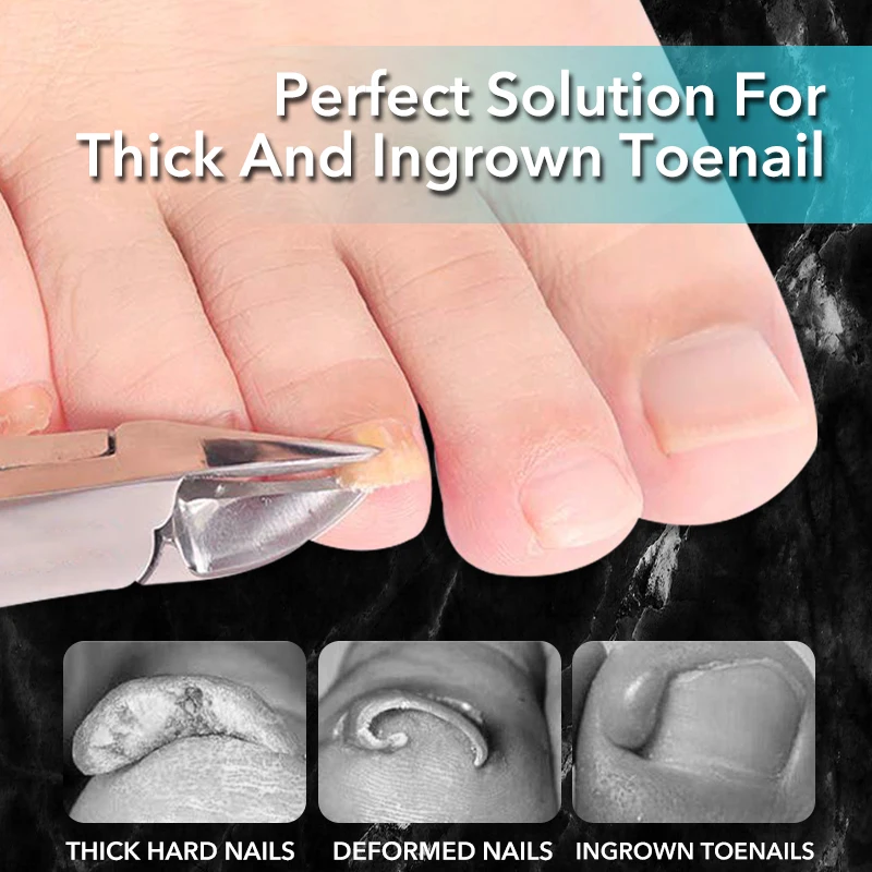1Pcs Thick Toenail Trimmer Clipper Stainless Steel Professional Paronychia Ingrown Nail Cutter Manicure Foot Care Pedicure Tool