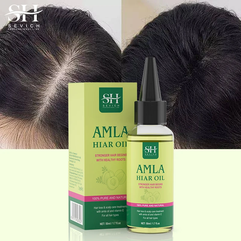 Original Amla Oil For Hair Growth India Gooseberry Hair Oil Anti Hair Loss Scalp Treatment Damaged Hair Repair Growing 50ml