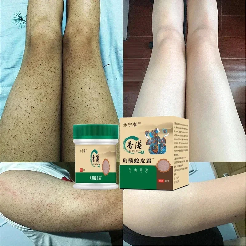 كريم إزالة جلد الدجاج ، إصلاح الجسم ، التقرن ، بيل...