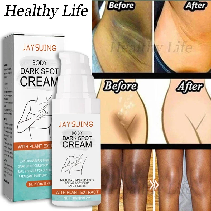 

Private Parts Whitening Cream Removing Melanin Lighten Underarm Knee Inner Thigh Brighten Serum Joint Dark Spots Bleach Lotion