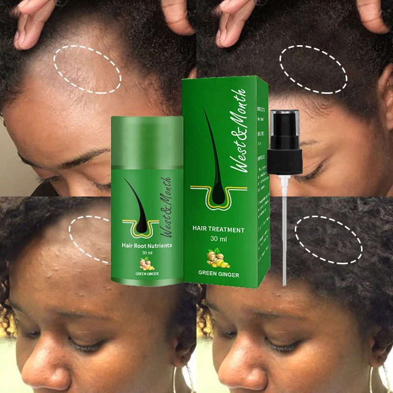 30ml Hair Care Hair Growth Serum Anti Hair Loss Thickening Hair Treatment  Oils Deep Moisturizing For All Hair Types - Hair & Scalp Treatments -  AliExpress